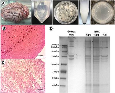 Combined 3D bioprinting and tissue-specific ECM system reveals the influence of brain matrix on stem cell differentiation